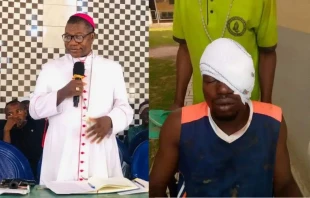 Bishop Mark Maigida Nzukwein of Nigeria's Wukari Diocese and one of the church stewards who lost an eye. Credit: Wukari Diocese